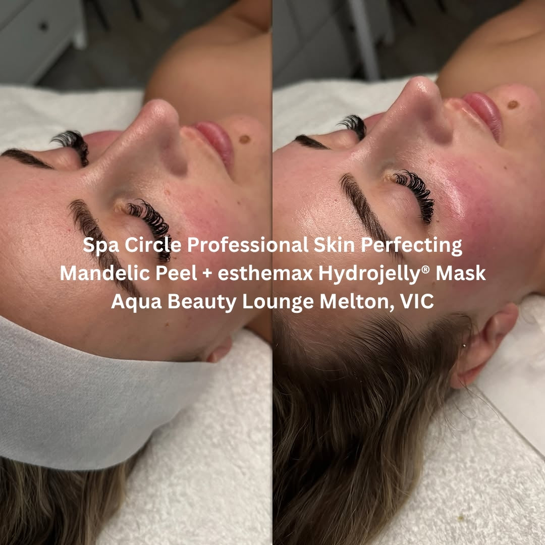 Before and after results after the Spa Circle Professional Mandelic Peel combined with esthemax Hydrojelly® Mask at Aqua Beauty Lounge Melton, VIC, showing calmer, clearer skin with a renewed glow.