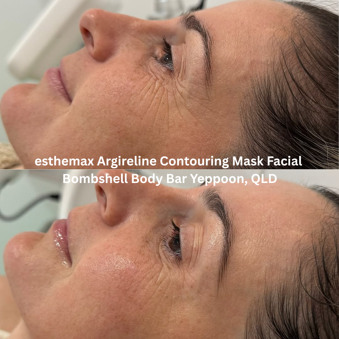 Before and after results of an esthemax® Argireline Contouring Mask Facial at Bombshell Body Bar in Yeppoon, Queensland. The client’s skin appears visibly smoother, lifted, and hydrated, with reduced fine lines and improved firmness around the eyes and cheeks.