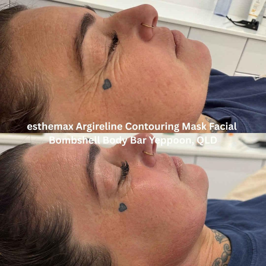 Before and after results after the esthemax Argireline Contouring Mask Facial at Bombshell Body Bar Yeppoon, QLD, showing calmer skin with improved circulation and a firmer appearance.