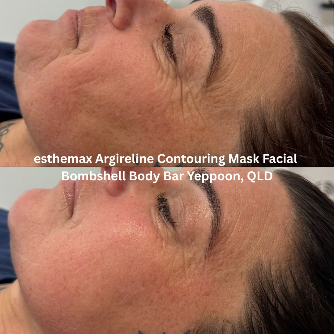 Before and after results after the esthemax Argireline Contouring Mask Facial at Bombshell Body Bar Yeppoon, QLD, revealing softer skin texture and improved definition through the cheeks and jawline.