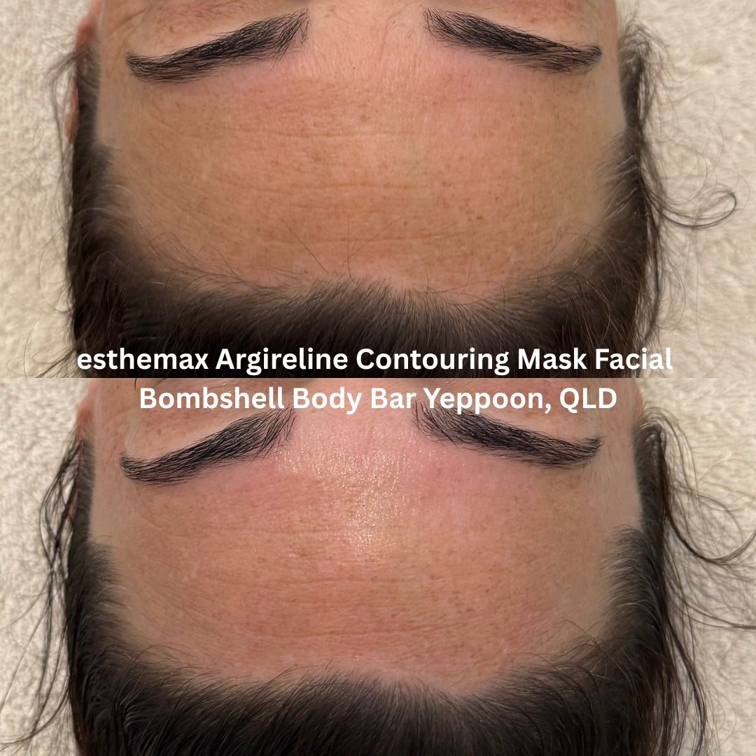 Before and after results after the esthemax Argireline Contouring Mask Facial at Bombshell Body Bar Yeppoon, QLD, revealing refined texture, improved elasticity, and smoother lines across the forehead.