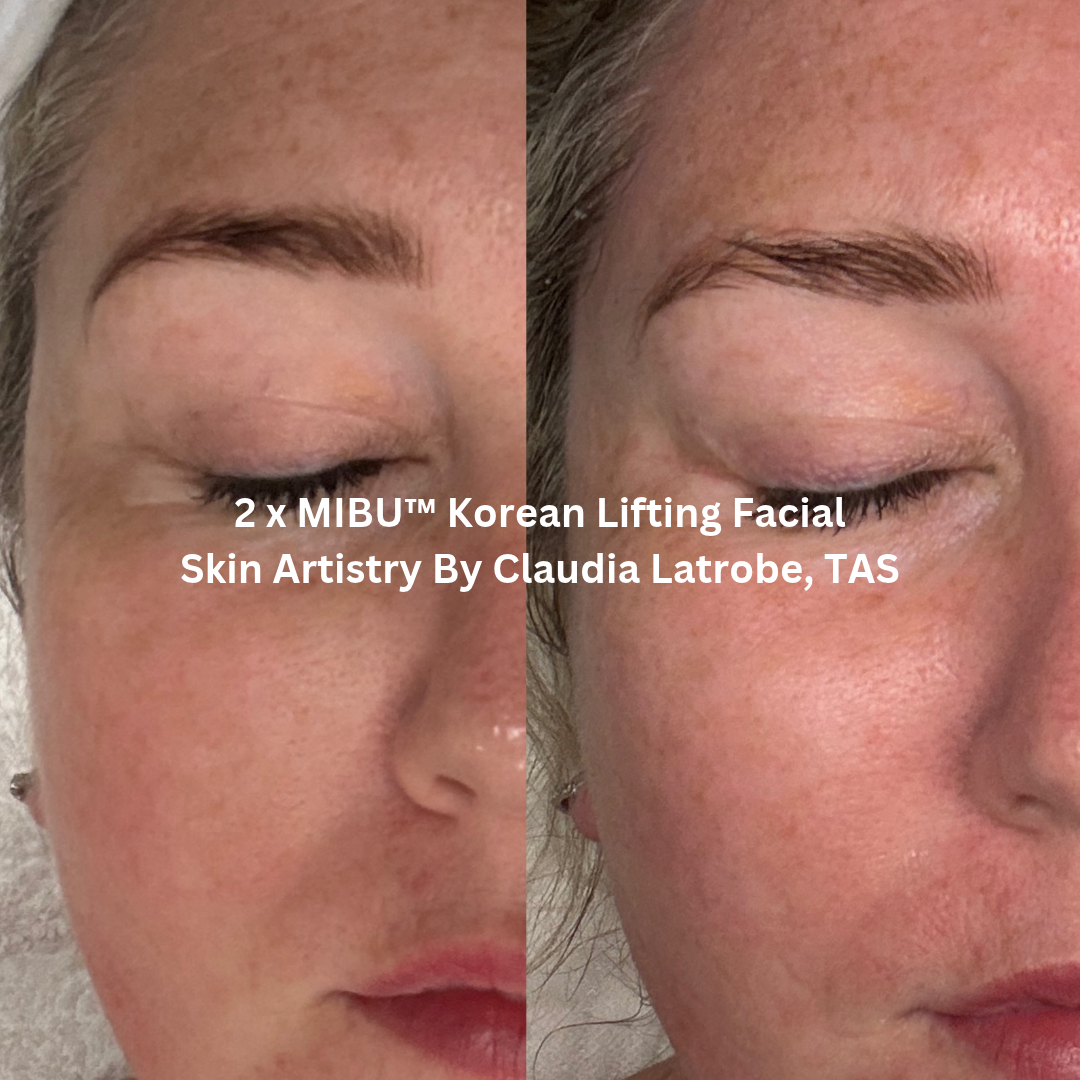 Before and after two MIBU™ Korean Lifting Facial treatments at Skin Artistry By Claudia, Latrobe TAS, showing the cheek and eye area with enhanced skin luminosity, smoother-looking texture and a refreshed appearance.
