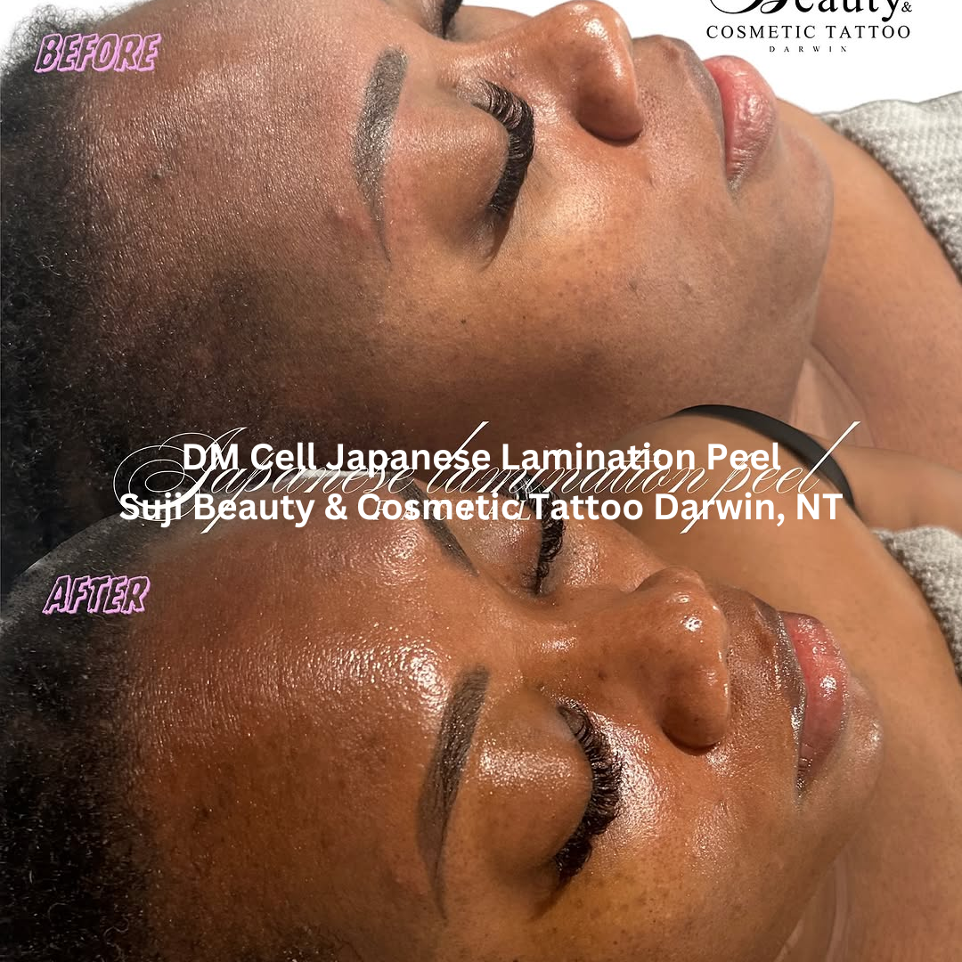 Before and after results of a DM Cell Japanese Lamination Peel performed at Suji Beauty & Cosmetic Tattoo in Darwin, Northern Territory. The skin appears smoother, brighter, and more even in tone, showing visible refinement in texture and enhanced radiance post-treatment.
