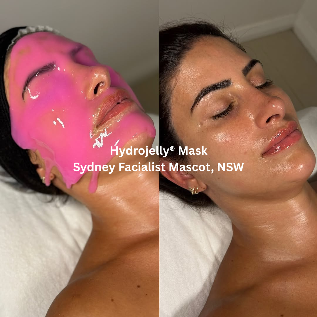 Before and after images following an esthemax Hydrojelly® Mask treatment at Sydney Facialist in Mascot, New South Wales. The after image shows deeply hydrated skin with enhanced luminosity, smoother-looking texture, and a healthy post-treatment glow.