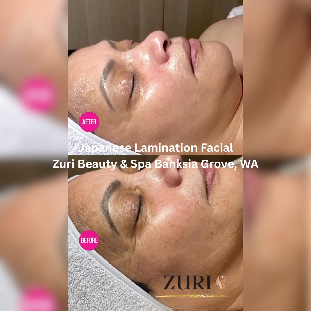 Side-profile before and after images of a Japanese Lamination Facial at Zuri Beauty & Spa in Banksia Grove, WA. The after image shows enhanced glow, improved hydration, and a more even-looking skin surface.