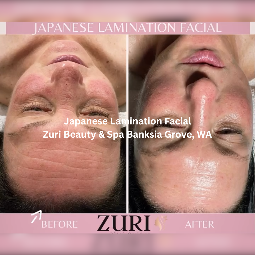 Front-facing before and after images of a Japanese Lamination Facial at Zuri Beauty & Spa in Banksia Grove, Western Australia. The after image shows increased skin luminosity, a smoother texture, and a glass-like finish across the forehead and cheeks.