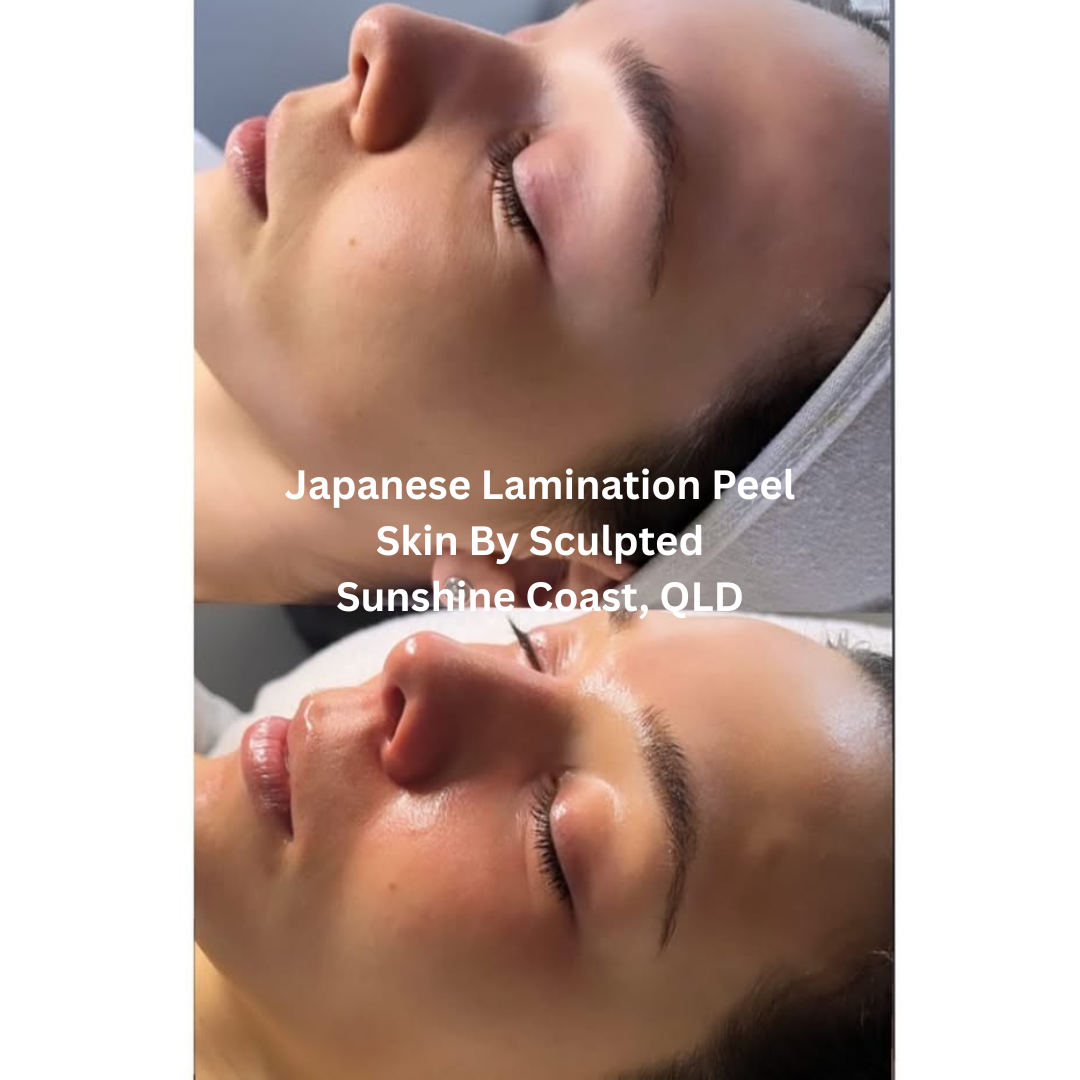 Before and after images of the face following a Japanese Lamination Peel at Skin By Sculpted on the Sunshine Coast, Queensland. The after image shows visibly brighter, more hydrated skin with a smoother, glass-like finish.