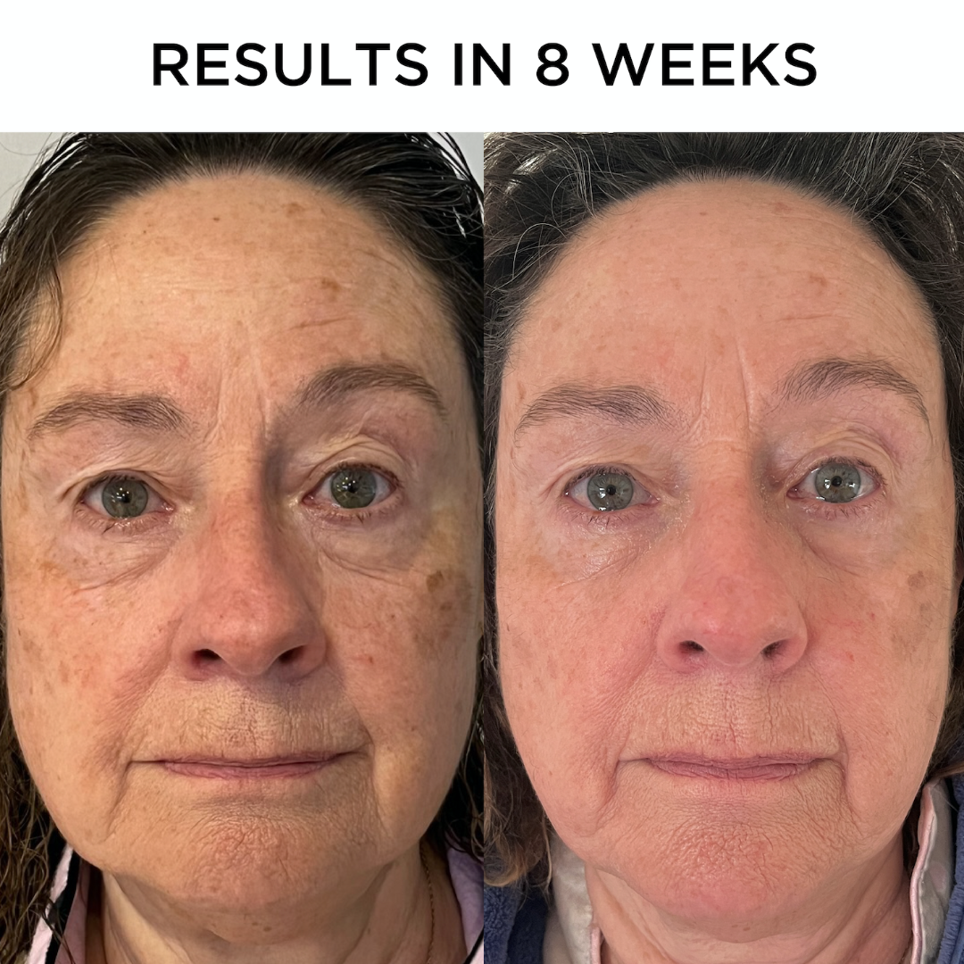 Before and after photo of a woman using Tribe Vitamin C Serum 50ml RRP, on Spa Circle Brands product listing page.