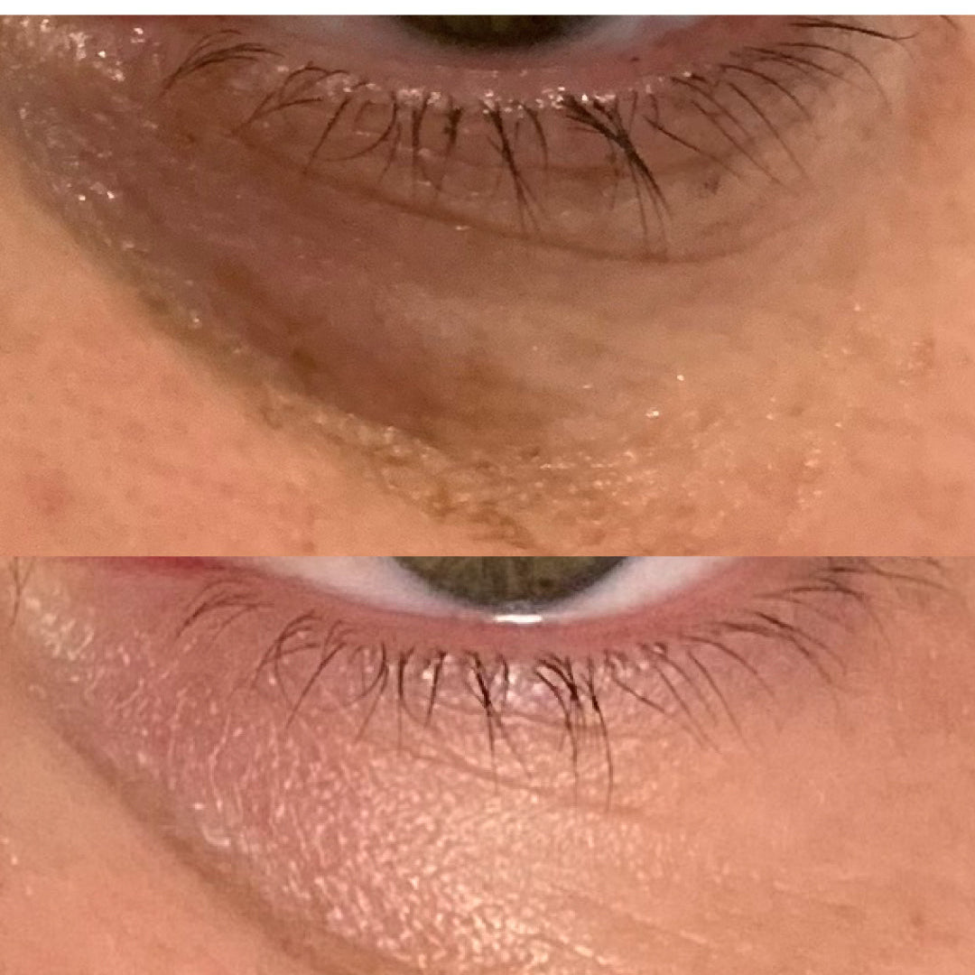 1-Month Visible Results: Photos showcasing under-eye improvements, featured on Spa Circle Brands' product listing