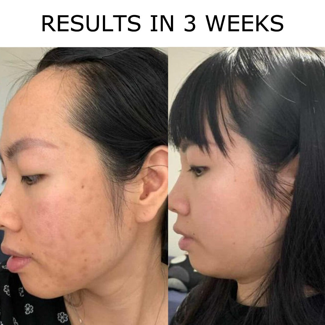 Noticeable Transformation: Before and After Photos of a woman's 3-week results using Tribe Repairing Facial Oil, highlighted on Spa Circle Brands' product listing.