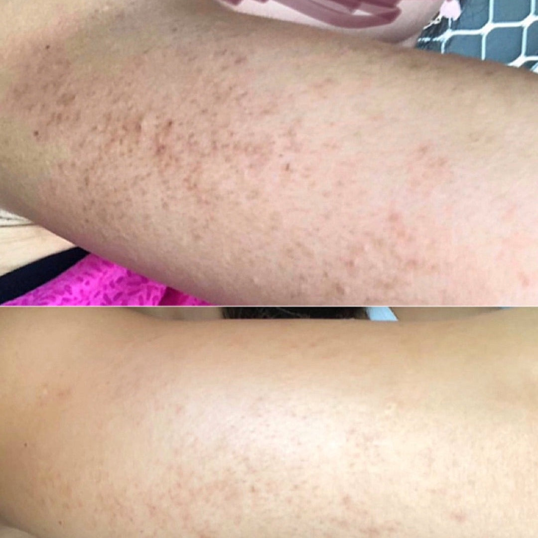 Evident Progress in 3 Weeks: Results from using Tribe Smoothing Body Moisturizer, showcased on Spa Circle Brands' product listing