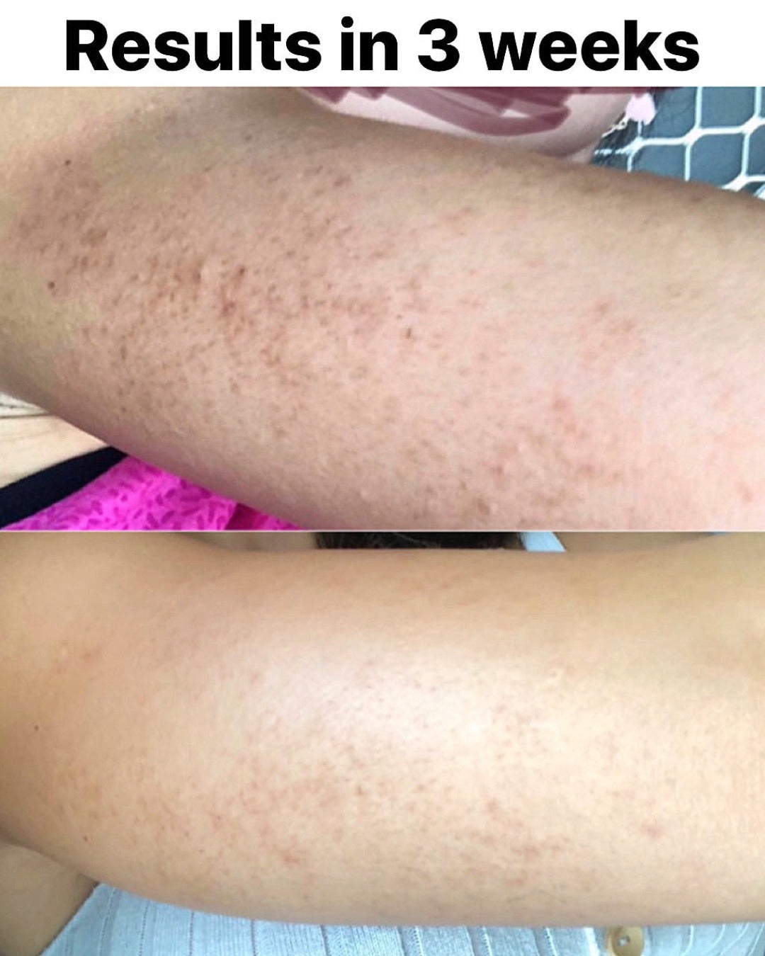 Evident Progress in 3 Weeks: Results from using Tribe Smoothing Body Moisturizer, showcased on Spa Circle Brands' product listing