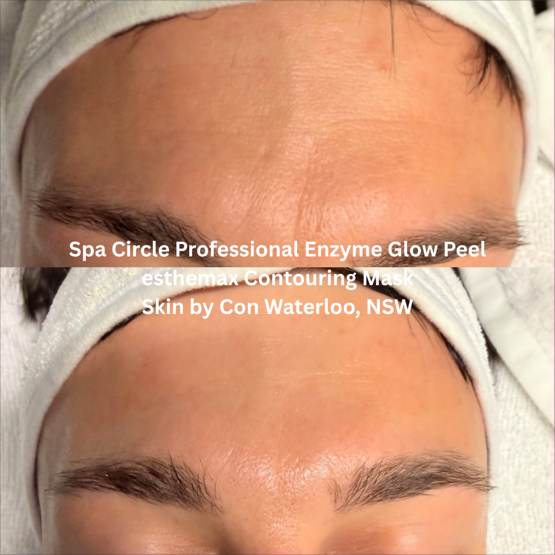 Before and after Spa Circle Professional Enzyme Glow Peel with esthemax Contouring Mask, showing smoother forehead texture, softened expression lines, and a brighter, hydrated complexion.