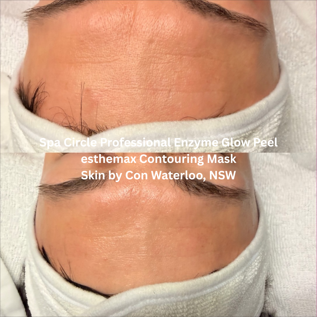 Before and after Spa Circle Professional Enzyme Glow Peel with esthemax Contouring Mask, demonstrating visibly smoother forehead lines, improved skin texture, and increased luminosity.