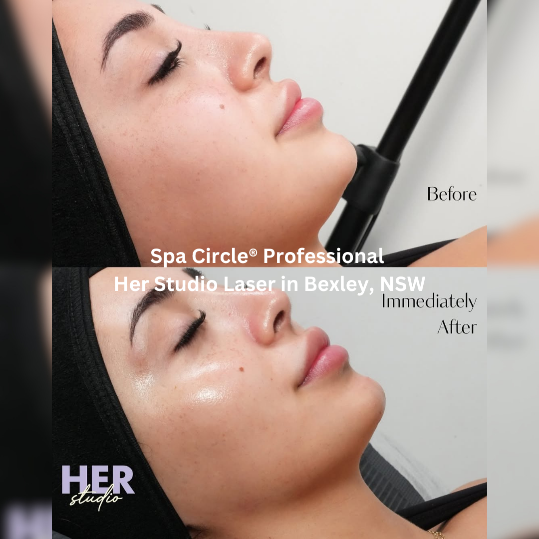 Her Studio Laser – Bexley, NSW
Before and immediately after Spa Circle professional Skin Perfecting Mandlic Peel treatment showing brighter, glass-like skin with increased luminosity and smooth, hydrated finish.