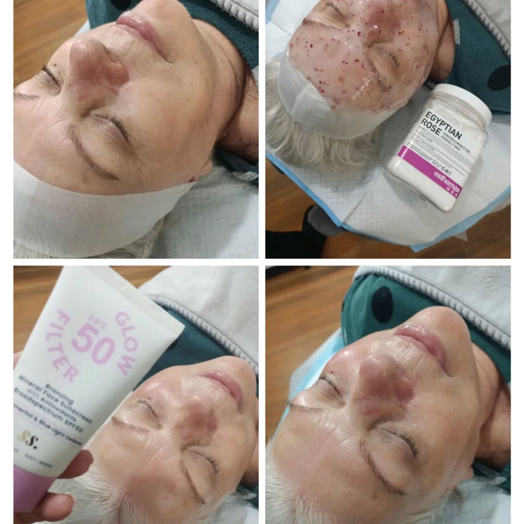 Before and after results after the esthemax Hydrojelly® Mask at Selective Beauty Bull Creek, WA, revealing nourished, soothed, and visibly hydrated skin. @selective_beauty