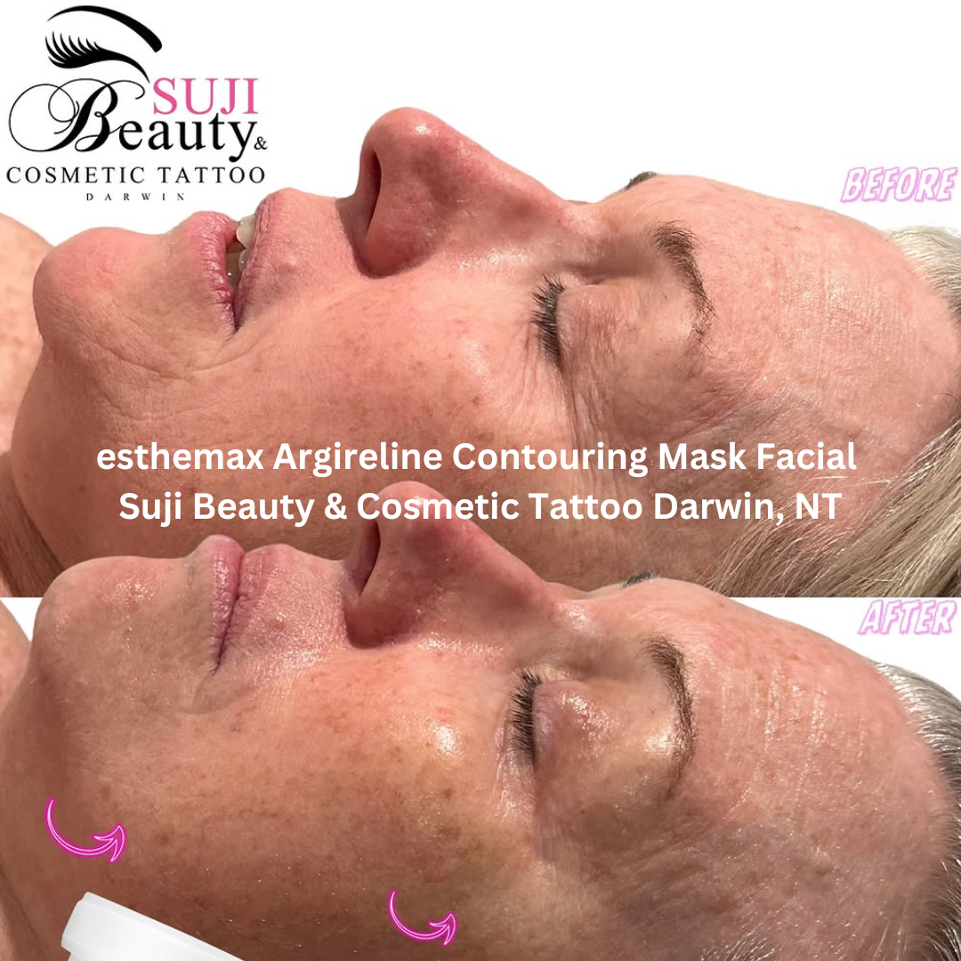 Before and after results of an esthemax® Argireline Contouring Mask Facial performed at Suji Beauty & Cosmetic Tattoo in Darwin, Northern Territory. The skin appears visibly firmer and smoother, with improved jawline contour and refined texture. Noticeable lifting and brightening effects can be seen around the lower face and cheek area.