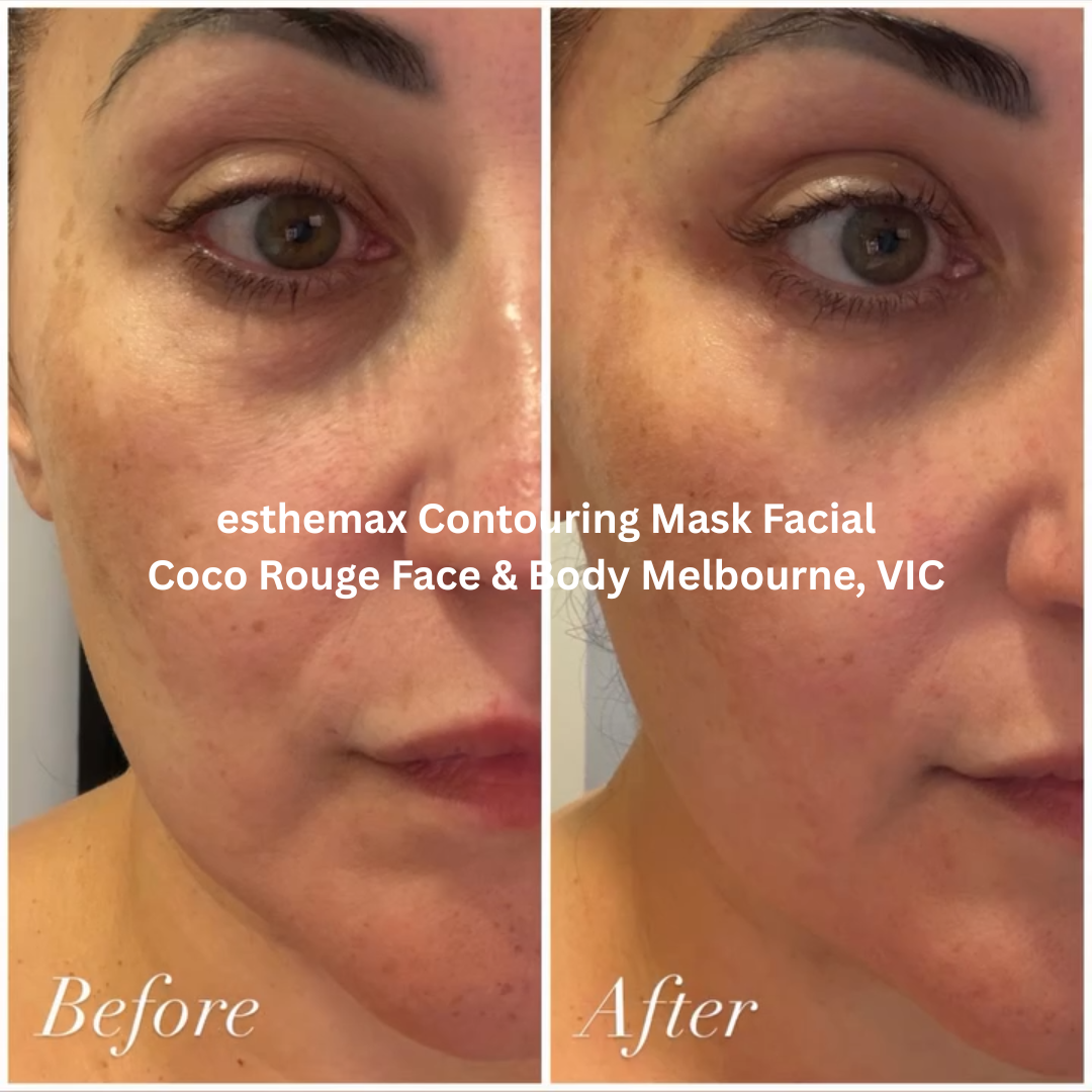 Before and after images of the face following an esthemax Contouring Mask Facial at Coco Rouge Face & Body in Melbourne, Victoria. The after image shows a brighter, more refreshed complexion with improved skin luminosity, hydration, and a smoother overall appearance.