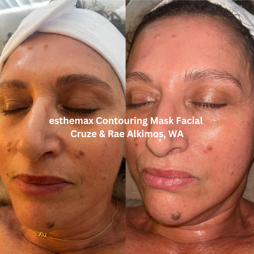 Before and after front-facing images following an esthemax® Contouring Mask Facial at Cruze & Rae in Alkimos, Western Australia. The after image shows skin that appears more luminous and hydrated with a smoother overall texture.