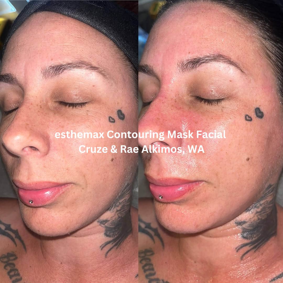Before and after side-profile images following an esthemax® Contouring Mask Facial at Cruze & Rae in Alkimos, Western Australia. The after image shows visibly hydrated skin with improved smoothness and a brighter, more radiant complexion across the cheek and jawline.