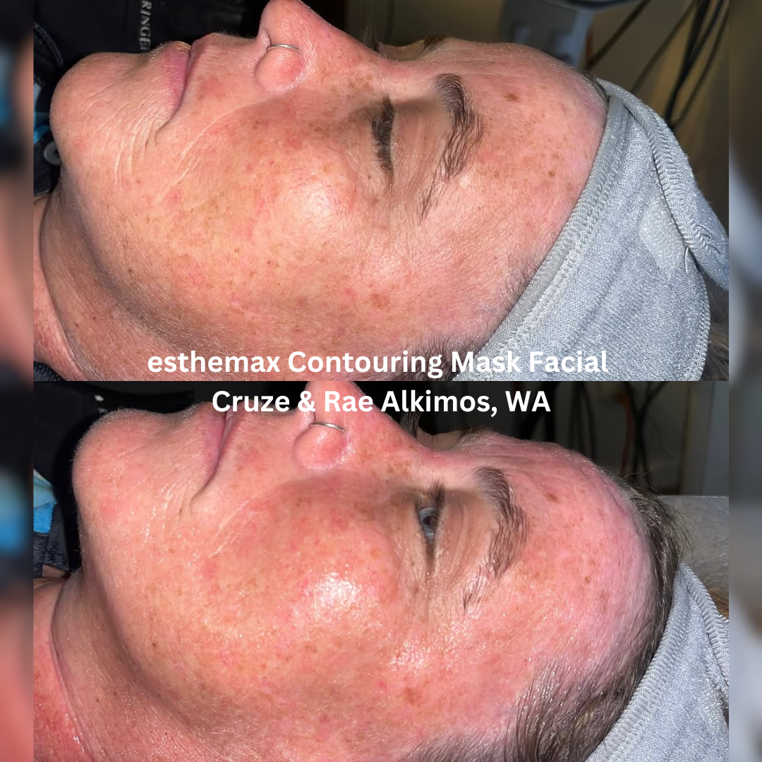 Before and after images of the face following an esthemax Contouring Mask Facial at Cruze & Rae in Alkimos, Western Australia. The after image shows a brighter, more lifted-looking complexion with enhanced glow and visibly refreshed skin.