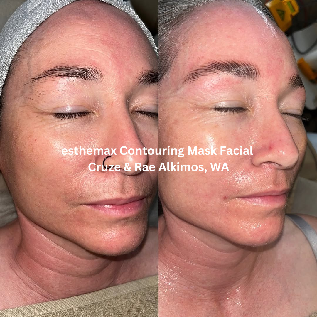 Before and after side-profile images following an esthemax® Contouring Mask Facial at Cruze & Rae in Alkimos, Western Australia. The after image shows visibly hydrated skin with improved smoothness and a more radiant, luminous complexion.