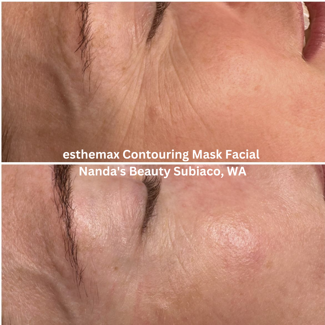 Before and after images of the eye area following an esthemax Contouring Mask Facial at Nanda’s Beauty in Subiaco, Western Australia. The after image shows smoother-looking skin with softened fine lines, improved hydration, and a more radiant complexion.