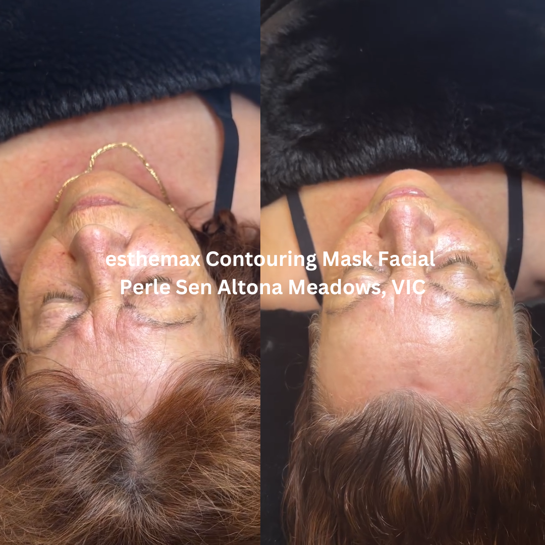 Before and after images of the face following an esthemax Contouring Mask Facial at Perle Sen in Altona Meadows, Victoria. The after image shows a more lifted, radiant complexion with smoother-looking skin and improved overall glow.