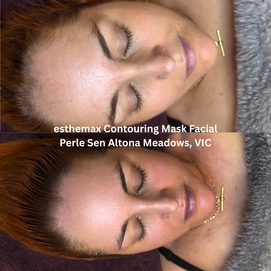 Before and after esthemax Contouring Mask Facial, highlighting improved skin radiance, refined texture, enhanced hydration, and a healthy post-treatment glow.