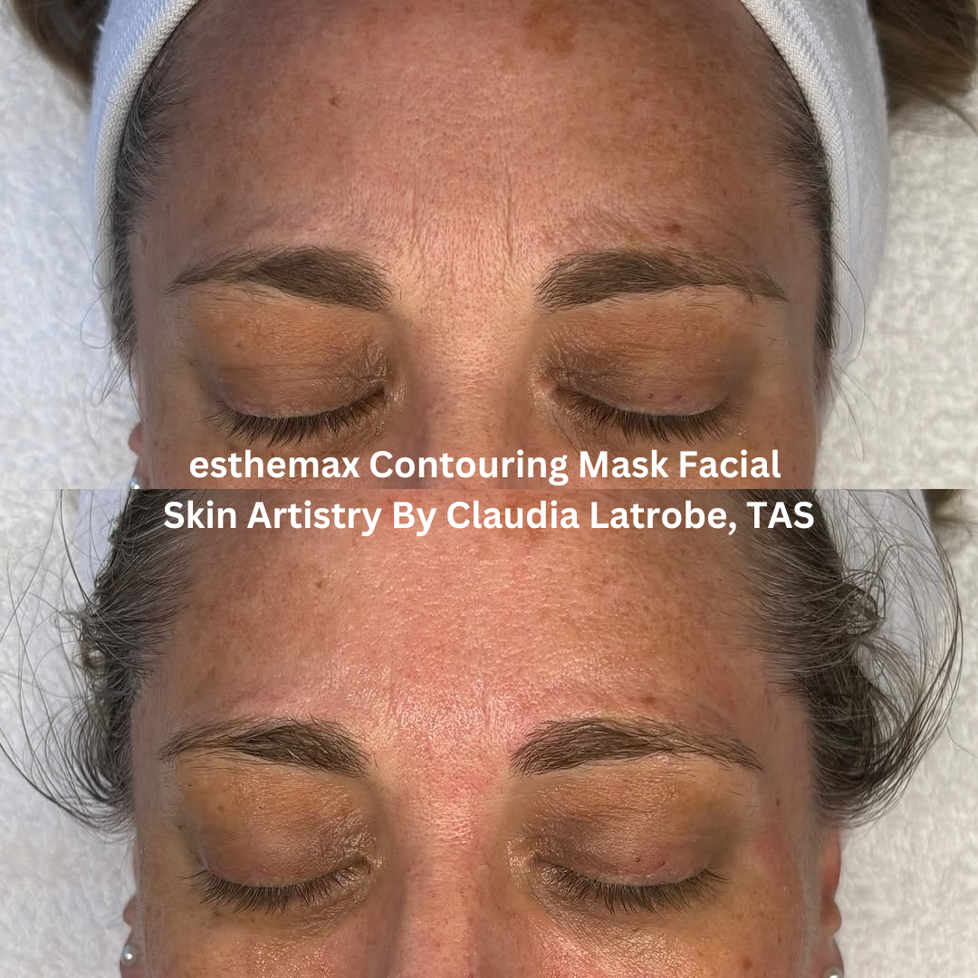 Before and after close-up images of the forehead following an esthemax® Contouring Mask Facial at Skin Artistry By Claudia in Latrobe, Tasmania. The after image shows refined skin texture with improved smoothness, hydration and a softer overall appearance.