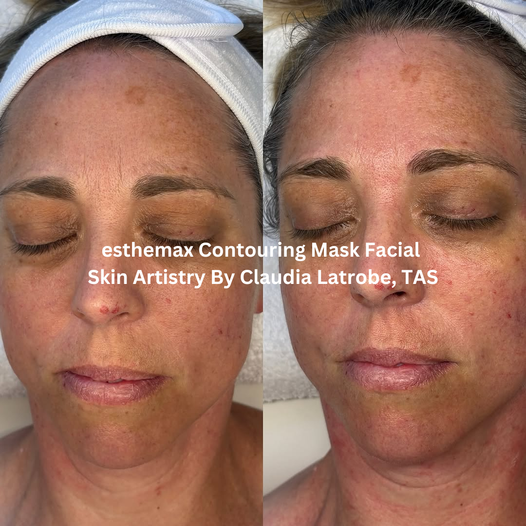 Before and after front-facing images following an esthemax® Contouring Mask Facial at Skin Artistry By Claudia in Latrobe, Tasmania. The after image shows visibly smoother-looking skin with improved hydration and a more even, radiant complexion.