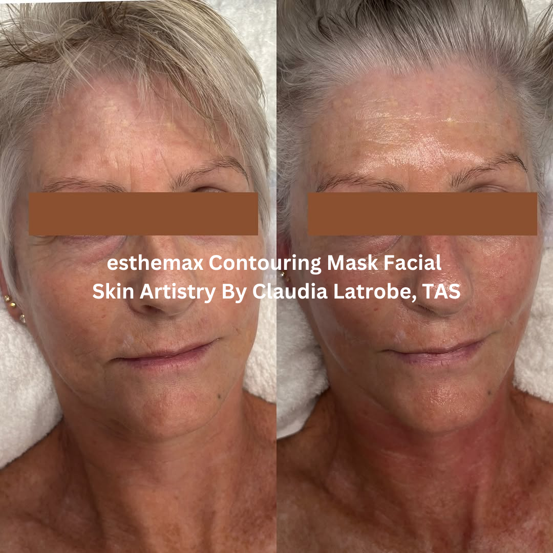 Before and after front-facing images following an esthemax® Contouring Mask Facial at Skin Artistry By Claudia in Latrobe, Tasmania. The after image shows smoother-looking skin with improved hydration and a brighter, more even-looking complexion.