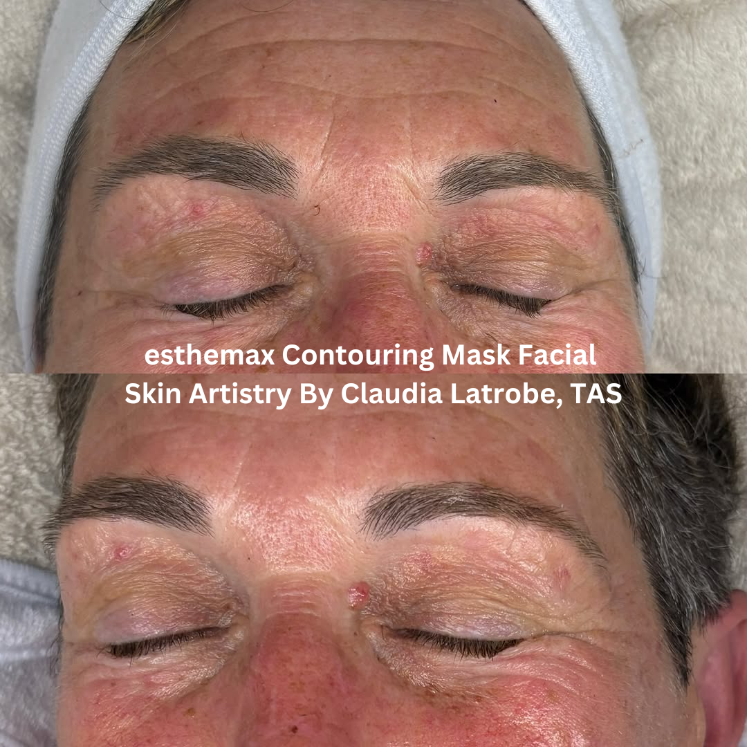 Before and after close-up images of the eye area following an esthemax® Contouring Mask Facial at Skin Artistry By Claudia in Latrobe, Tasmania. The after image shows smoother-looking skin with improved hydration and a brighter, more refreshed appearance around the eyes.