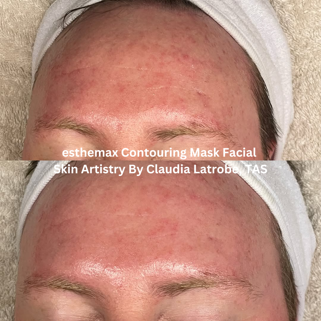Before and after close-up images of the forehead following an esthemax® Contouring Mask Facial at Skin Artistry By Claudia in Latrobe, Tasmania. The after image shows a smoother-looking surface with more even tone and visible hydration across the forehead.