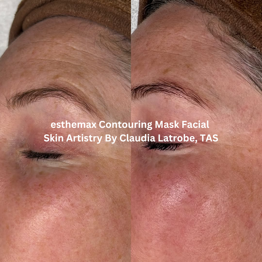 Before and after side-by-side images of the eye and upper cheek area following an esthemax® Contouring Mask Facial at Skin Artistry By Claudia in Latrobe, Tasmania. The after image shows improved smoothness, enhanced glow, and a more refreshed appearance around the eyes.