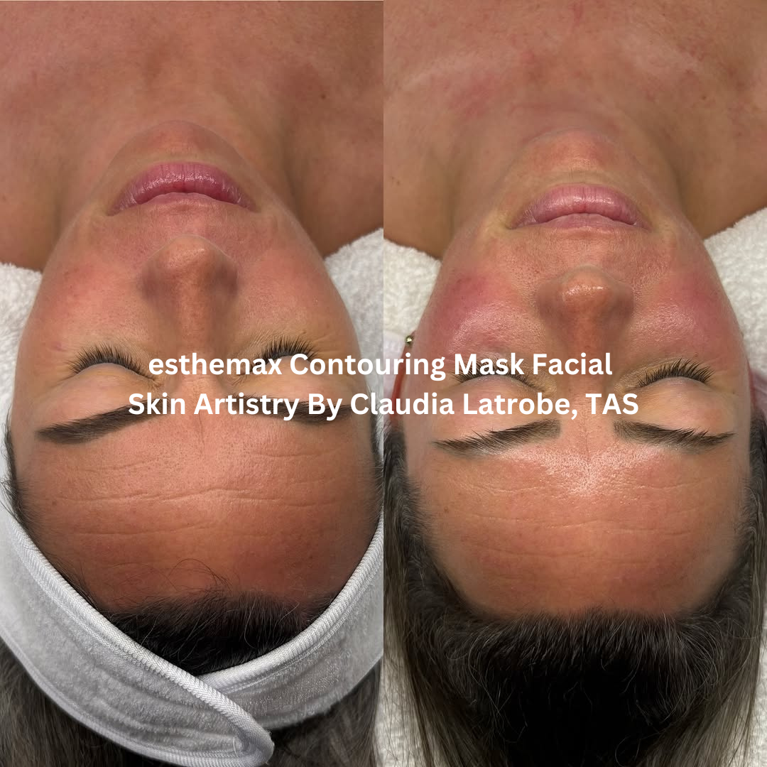 Skin Artistry by Claudia – Latrobe, TAS
Before and after esthemax Contouring Mask facial showing reduced redness, smoother forehead lines, and a more even, luminous complexion.