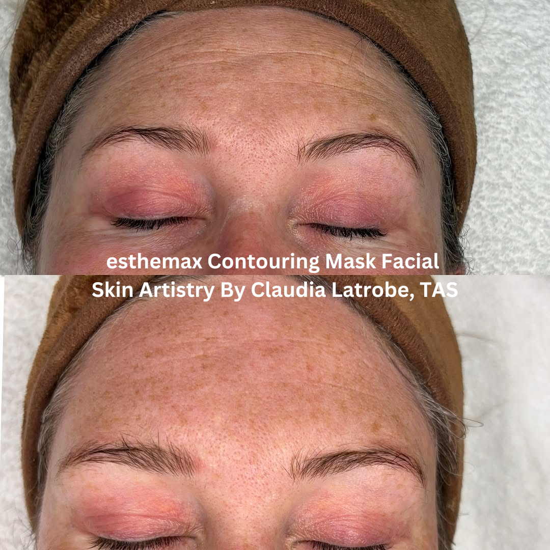 Before and after close-up images of the forehead following an esthemax® Contouring Mask Facial at Skin Artistry By Claudia in Latrobe, Tasmania. The after image shows refined skin texture with improved smoothness and a softer overall appearance.