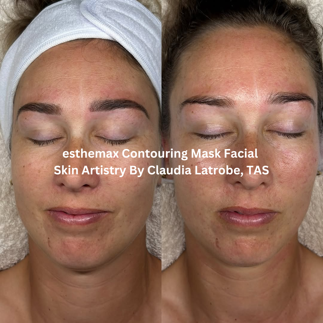 Before and after front-facing images following an esthemax® Contouring Mask Facial at Skin Artistry By Claudia in Latrobe, Tasmania. The after image shows smoother-looking skin with improved hydration and a more even tone across the forehead, cheeks, and chin.