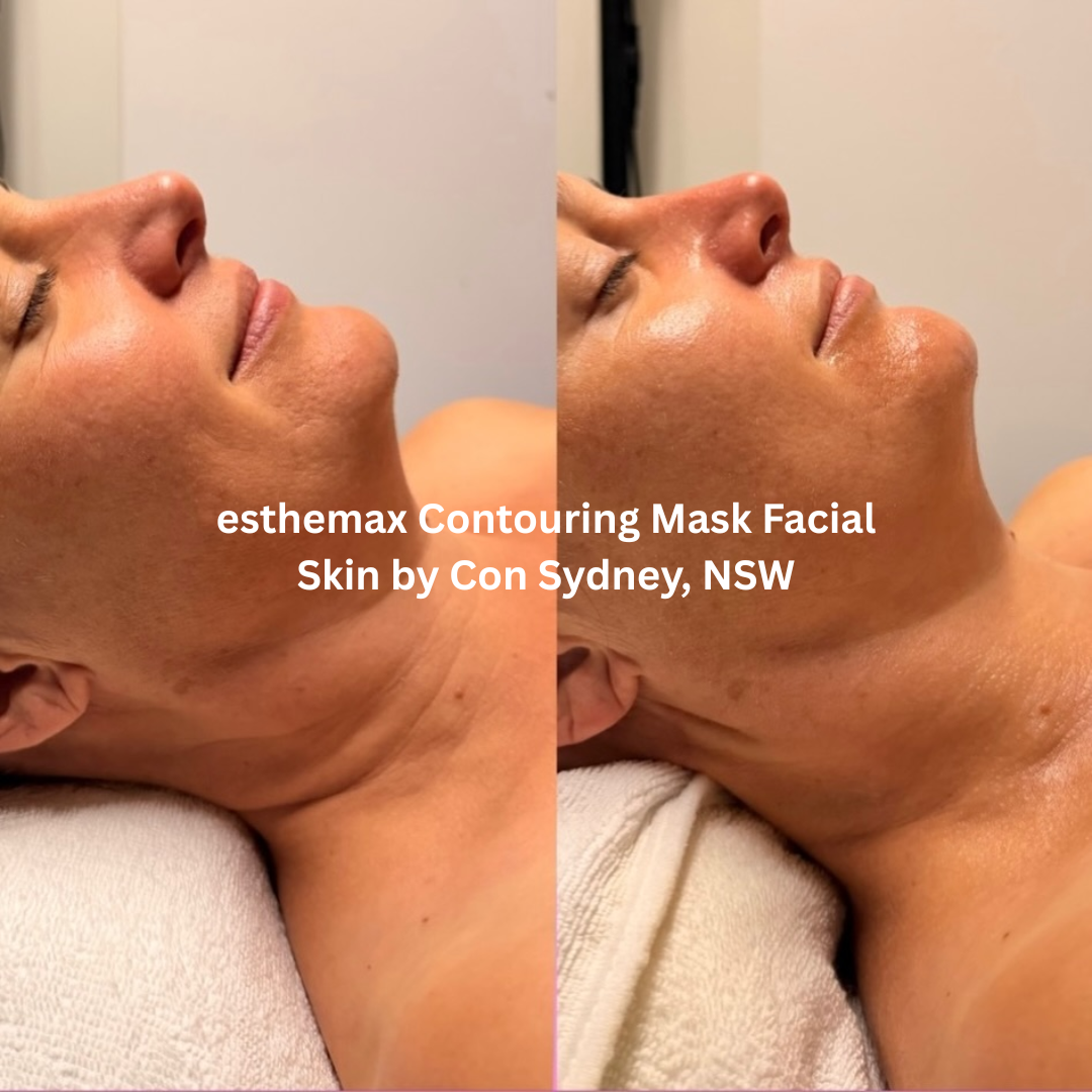 Before and after esthemax Contouring Mask Facial at Skin by Con, Sydney NSW, showing improved facial definition, smoother-looking skin and enhanced radiance.