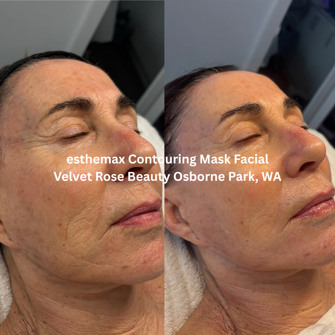 Before and after esthemax Contouring Mask Facial, highlighting increased skin radiance, refined texture, and a healthy, hydrated glow.