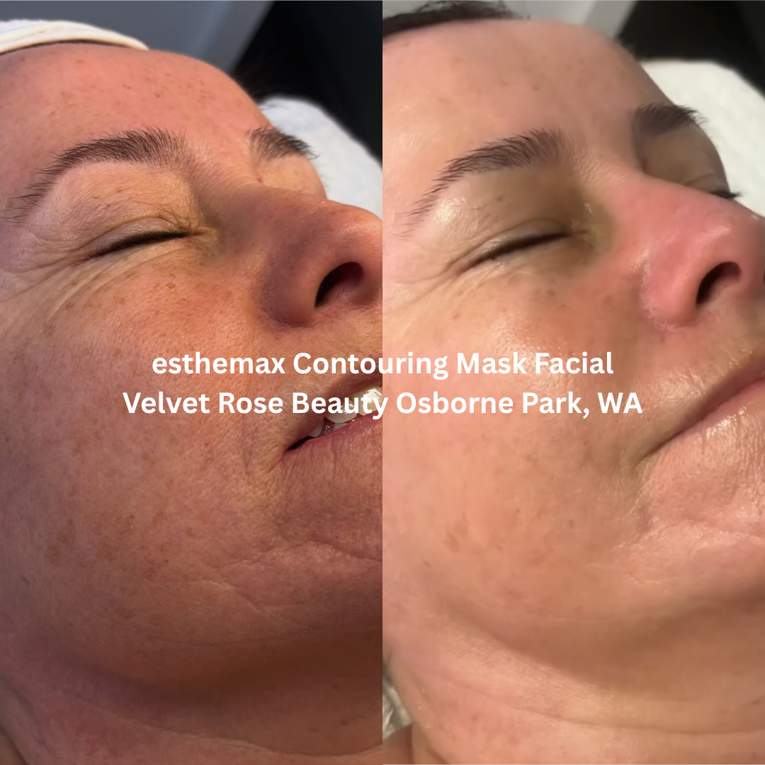 Before and after esthemax Contouring Mask Facial, demonstrating smoother skin texture, improved hydration, and a brighter, more luminous complexion.