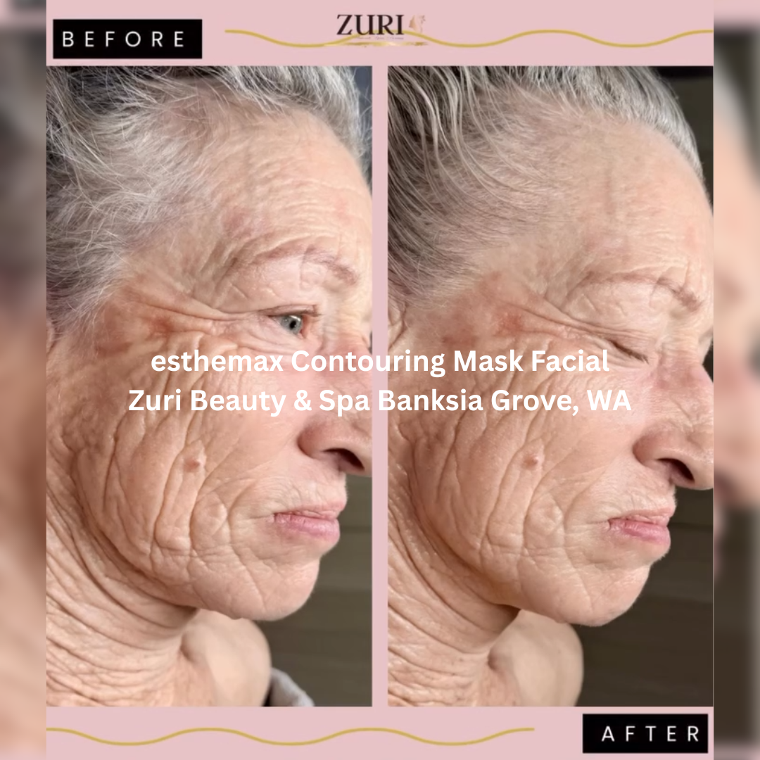 Before and after images of the face following an esthemax Contouring Mask Facial at Zuri Beauty & Spa in Banksia Grove, Western Australia. The after image shows a more radiant complexion with improved skin hydration, luminosity, and a visibly refreshed appearance.