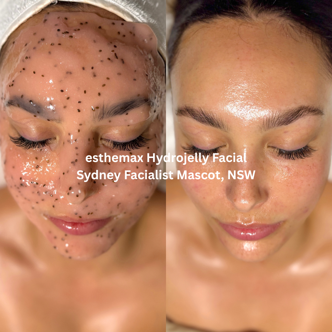 esthemax Hydrojelly Facial during and after treatment at Sydney Facialist, Mascot NSW, showing hydrated, dewy and luminous-looking skin.