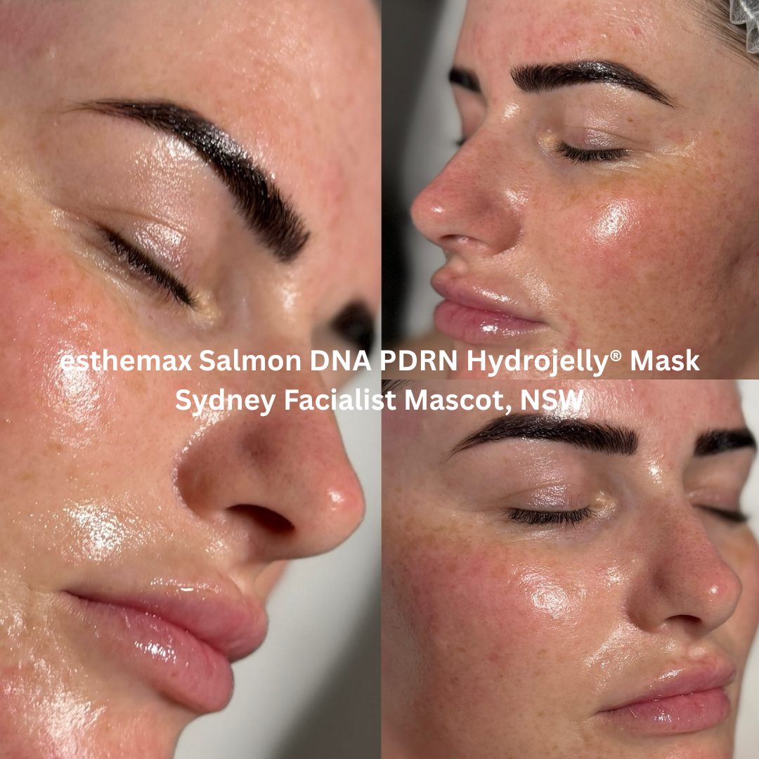 Results of an esthemax® Salmon DNA PDRN Hydrojelly® Mask at Sydney Facialist in Mascot, New South Wales. The treatment leaves the skin dewy, hydrated, and revitalised, with a luminous glow and smoother surface.