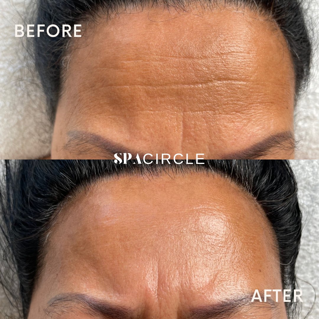 Spa Circle Professional TRADE Skin Perfecting Mandelic Peel 100ml - Spa Circle Australia Wholesale Skincare for Beauty Salons, Day Spas and Skin Clinics